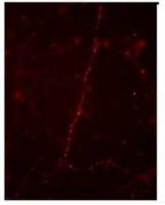 Immunohistochemistry: Synapsin I [p Ser9] Antibody [NB300-180] - Cultured mouse caudate neurons showing synapsin I when phosphorylated at Ser9